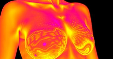 Brust-Thermografie nicht als Ersatz