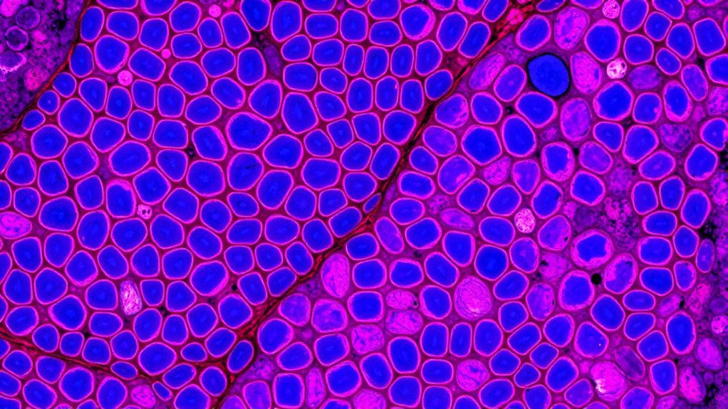 Tumorgrad gibt die Zellreife an