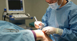 Not Ready for a Knee Replacement? A Minimally Invasive Procedure May Ease Chronic Pain Without Joint Replacement